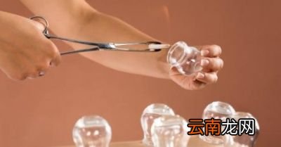 拔罐可以拔出湿气和寒气吗