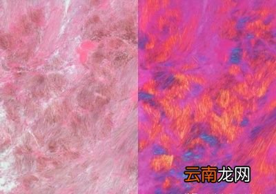 尿酸高的人群适合什么菜肴呢