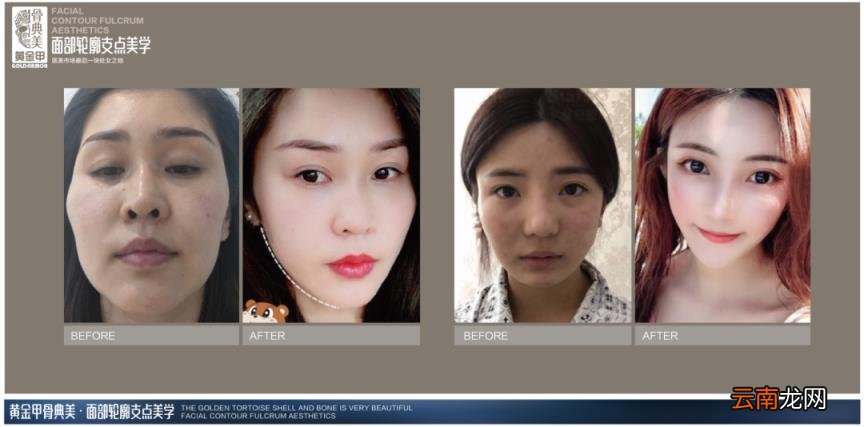 张柏芝顶级“抗老脸”骨相是什么样的?教你区分皮相美和骨相美!