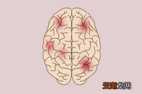 鉴别地沟油的方法 如何鉴别地沟油