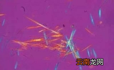 高嘌呤食物是让尿酸升高的主因吗