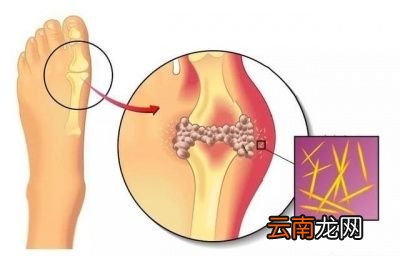 又有哪些食物其实嘌呤含量并不高