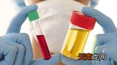 哪些食物中含嘌呤高