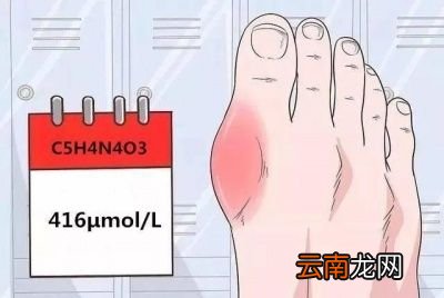 哪些食物中含嘌呤高