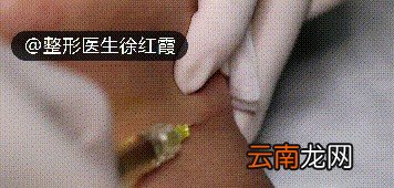 颈纹越来越多的原因