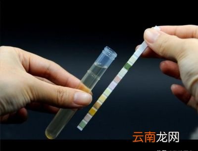 有人说长期尿黄是不是肾有问题呢