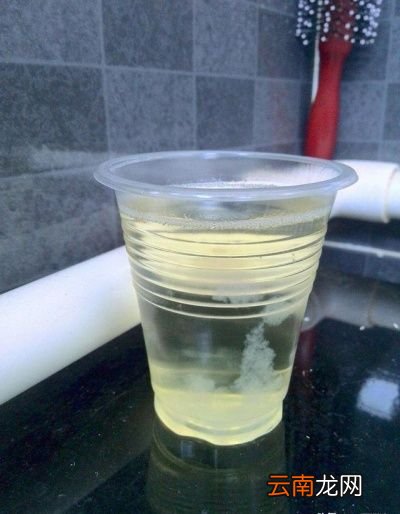 尿液颜色深是生理性还是病理性