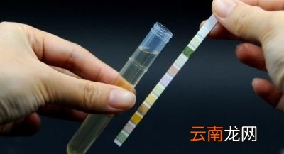 尿液颜色一直很黄可能是什么原因呢