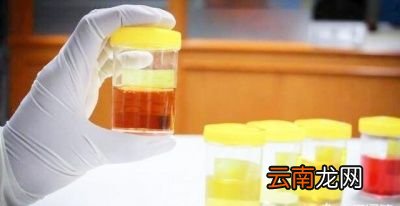 尿色发黄的原因
