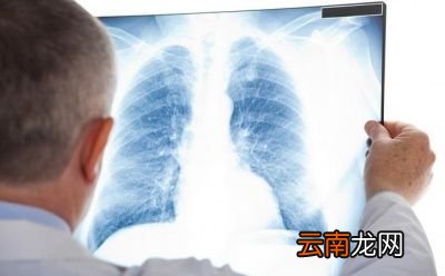 日常中如何预防肺结节