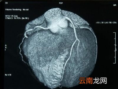 心脏病患者的主要检查项目包括以下几方面