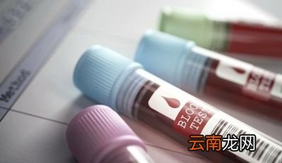 心脏病患者的主要检查项目包括以下几方面