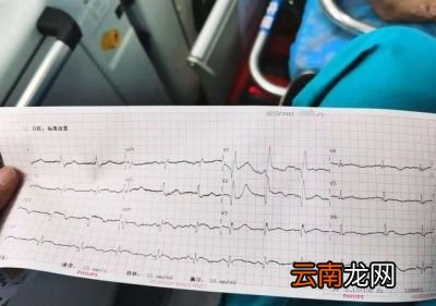 心脏病患者的主要检查项目包括以下几方面