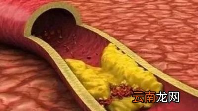 山楂有六大功效