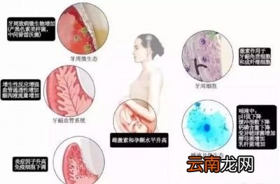 有哪些关于孕妇口腔问题的误区