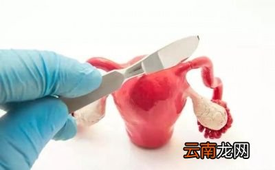 子宫肌瘤需手术治疗吗