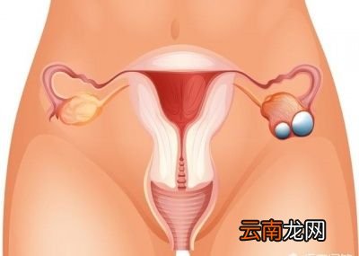 子宫肌瘤一定要动手术吗