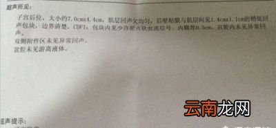 子宫肌瘤需不需要手术呢