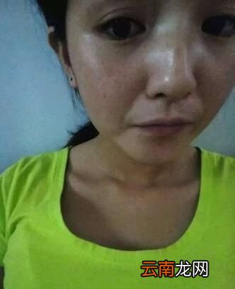 有哪些美白祛斑的好方法呢