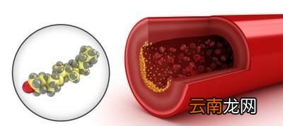 脑梗和心梗是怎么发生