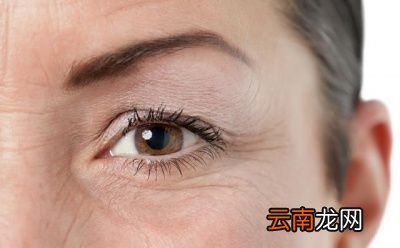 如何通过脸上皱纹看出疾病