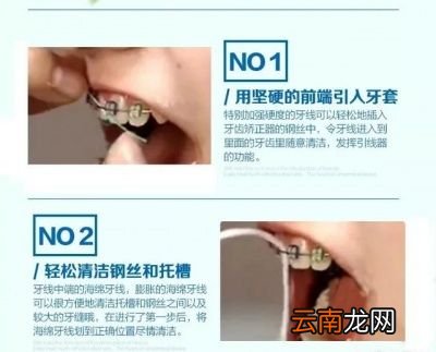 为什么要用牙线或牙线棒