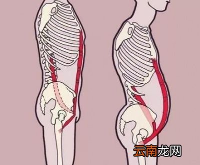 此类脂肪肚应该怎么去减下去呢