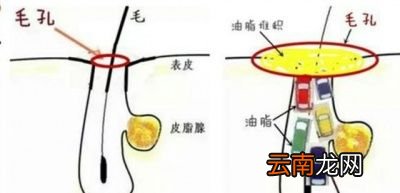 粉底和BB霜哪个对皮肤的伤害更大