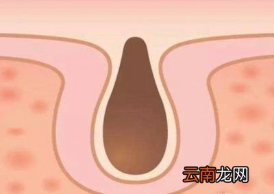 粉底和BB霜哪个对皮肤的伤害更大