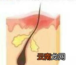 粉底和BB霜哪个对皮肤的伤害更大