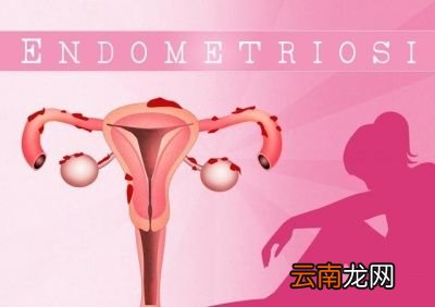 到底多少岁绝经才是正常的呢