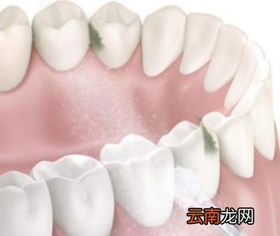牙线和冲牙器相比有什么优点