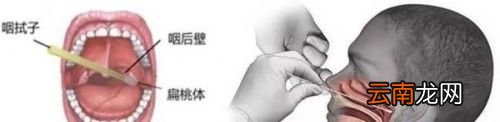 核酸检测可以检测什么病毒