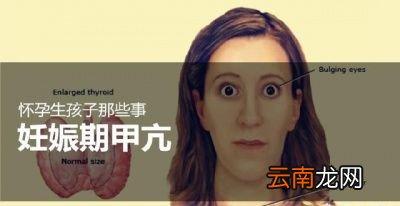 妊娠期甲亢会影响孩子吗