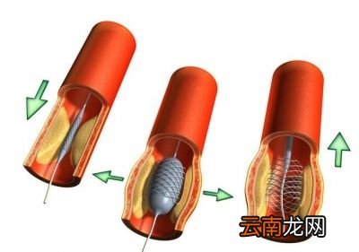 为什么这么建议呢有以下理由