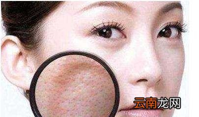 毛孔粗大能彻底恢复吗