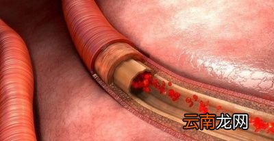 血压是如何产生的