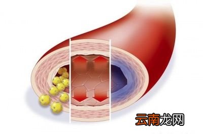 血压是如何产生的