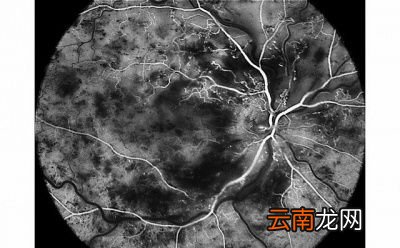 何为收缩压舒张压二者有何区别