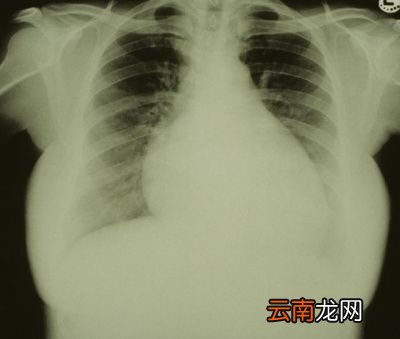 何为收缩压舒张压二者有何区别