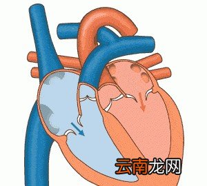 血压到底看高压还是低压