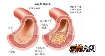 说了多那低压高与高压高对人体的影响有哪些