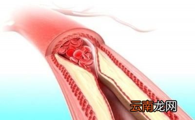 高压与低压是什么意思