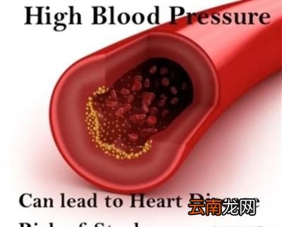 低压过高是什么意思