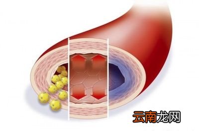什么是高压什么是低压