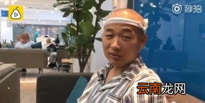 头发移植后会脱发吗