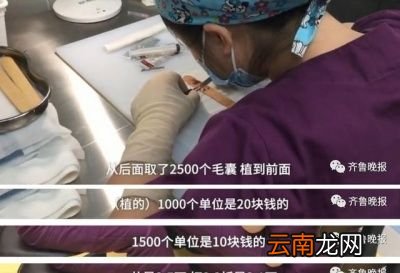 头发移植后会脱发吗