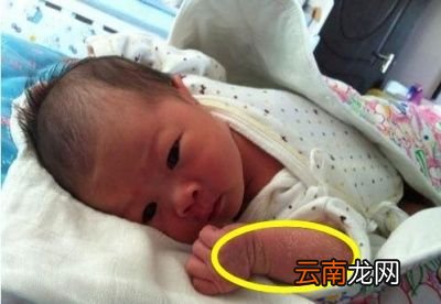 新生儿身上有褪皮怎么回事