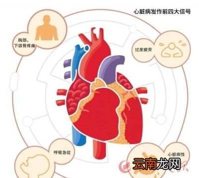 临床上如何区分真假冠心病