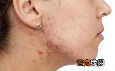喝牛奶应该喝多少呢